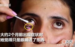 女子患怪病流水晶泪，一天可最多产出50颗，每天犹如地狱般生活