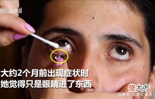 女子患怪病流水晶泪，一天可最多产出50颗，每天犹如地狱般生活