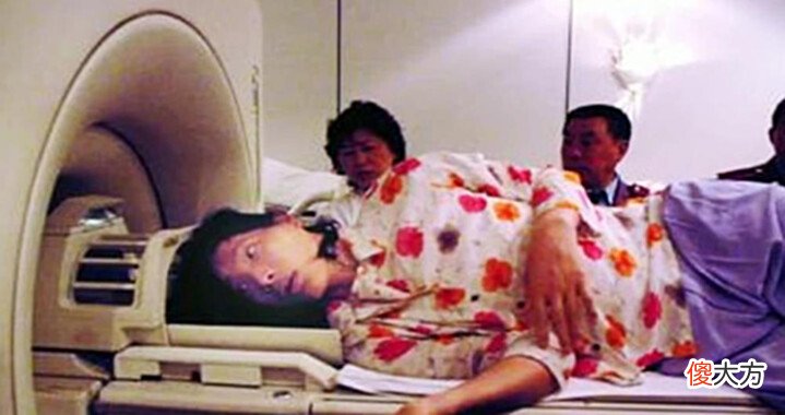 【历史故事】“世界第一女巨人”:比姚明高半个头,鞋子78码,一顿二斤白米饭