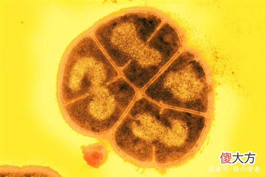 超强细菌被发现，能在太空中存活3年，或能佐证外星生命遍布宇宙