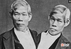史上第一对连体人是中泰混血，娶了一对英国姐妹，生下21个孩子