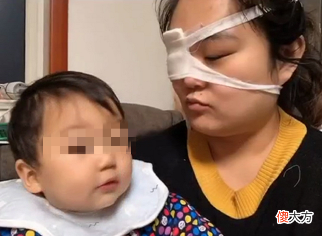 小宝宝杀伤力有多强？宝妈：我为你剖腹7层，你却让我变“独眼”