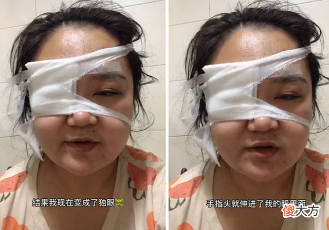 小宝宝杀伤力有多强？宝妈：我为你剖腹7层，你却让我变“独眼”