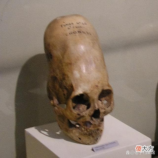 帕拉卡斯头骨来源成谜，基因检测，竟是外来物种？