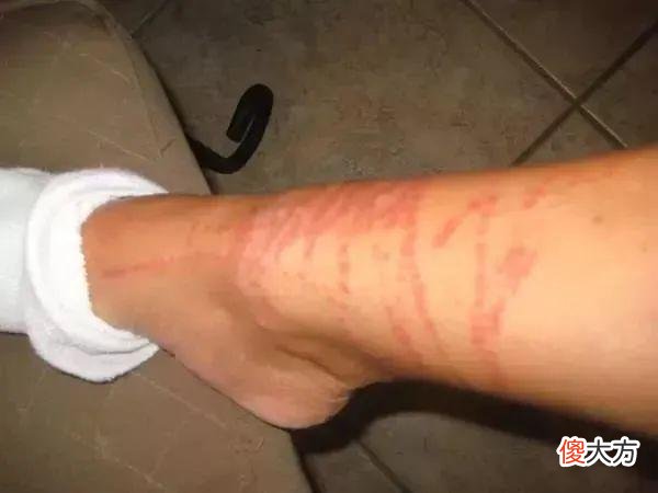 大片梦幻蓝色占据澳洲海岸，专家喊别碰：能致命，上万人因它送医