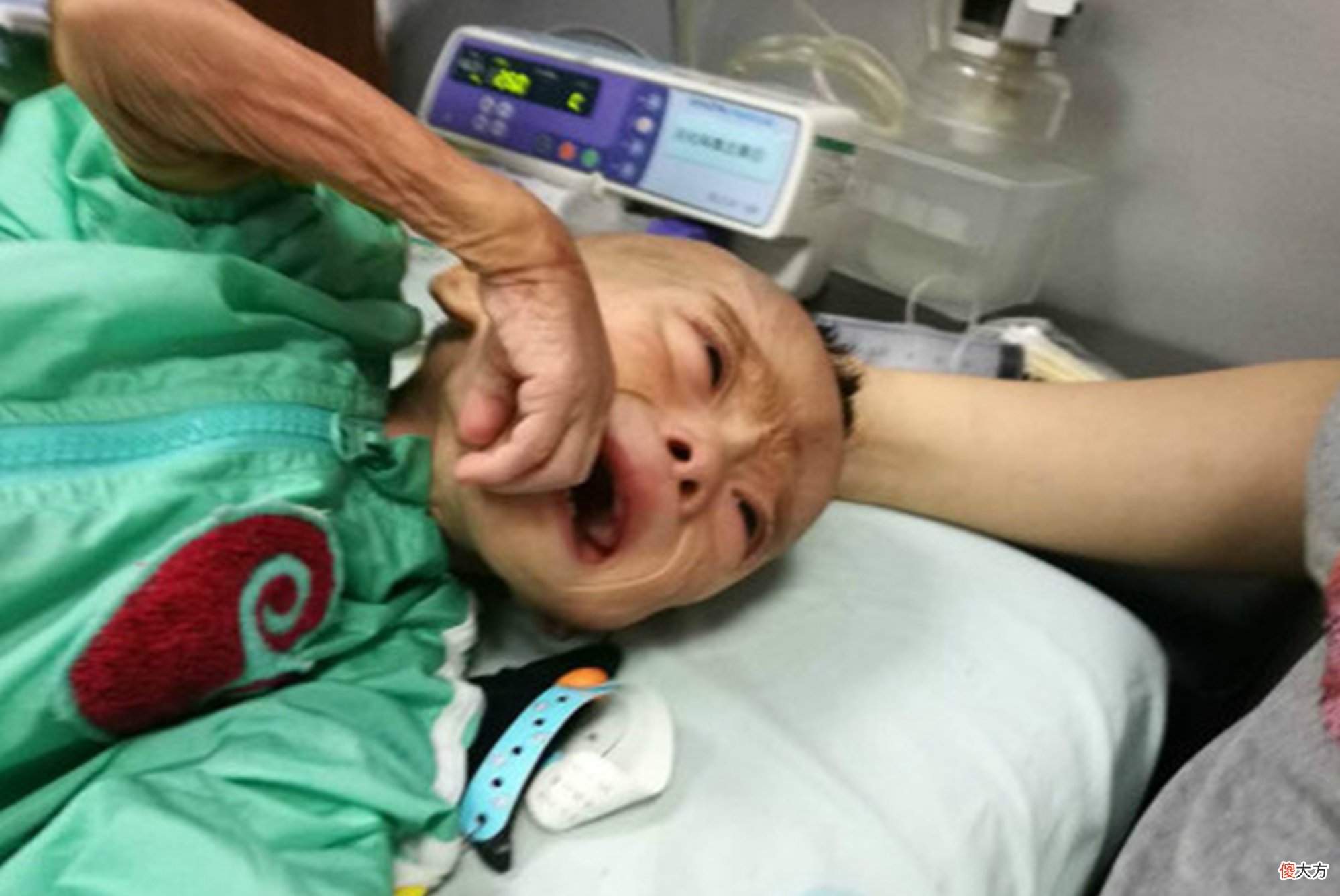 6岁男童积食不长个,医生看舌苔后捂鼻问:“防腐剂”吃了多少