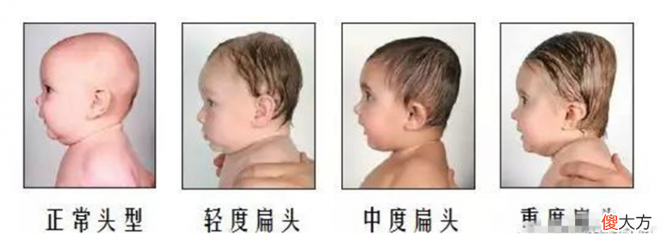 “脑勺高，聪明包”，这种头型的娃智商高人一等？家长别被误导
