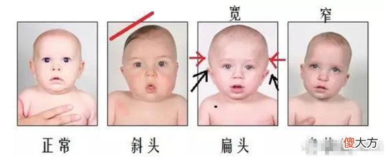 “脑勺高，聪明包”，这种头型的娃智商高人一等？家长别被误导