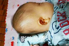 老一辈坚持给孩子“睡扁头”，难道人与人之间的审美差距这么大？