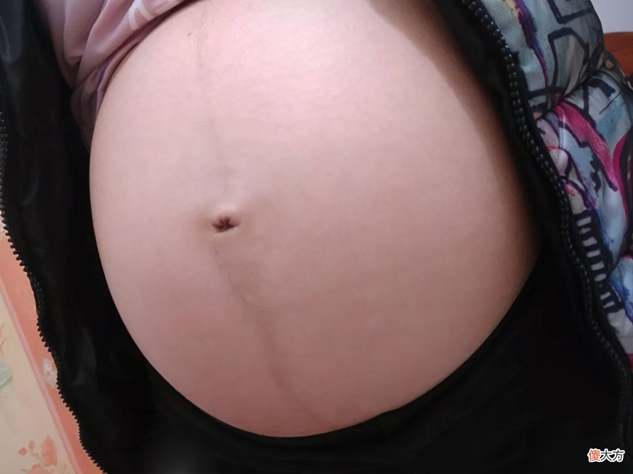 为啥准妈妈腹部有一条黑线?与3个因素有关,好处让人无法拒绝