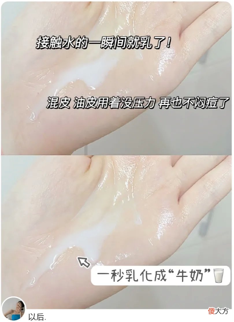 【就爱时尚】油性肌肤一直长痘痘，怎么办？