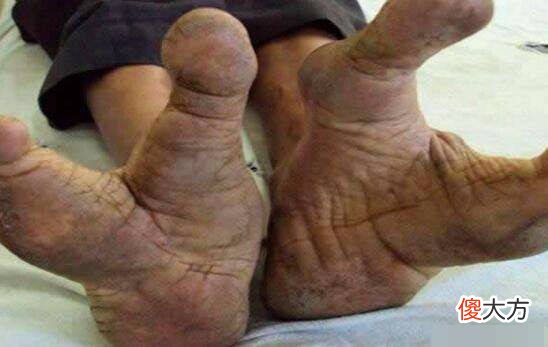 【历史故事】原始森林中的“龙虾部落”，人人仅有2根脚趾，专家：难以理解