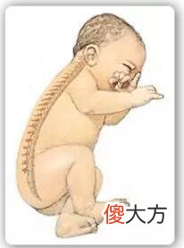 从小给孩子睡枕头，会给孩子身体带来伤害，附枕头正确挑选方式