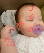 蚊子专咬O型血的宝宝？夏季防蚊正当时，不妨试试这3大妙招