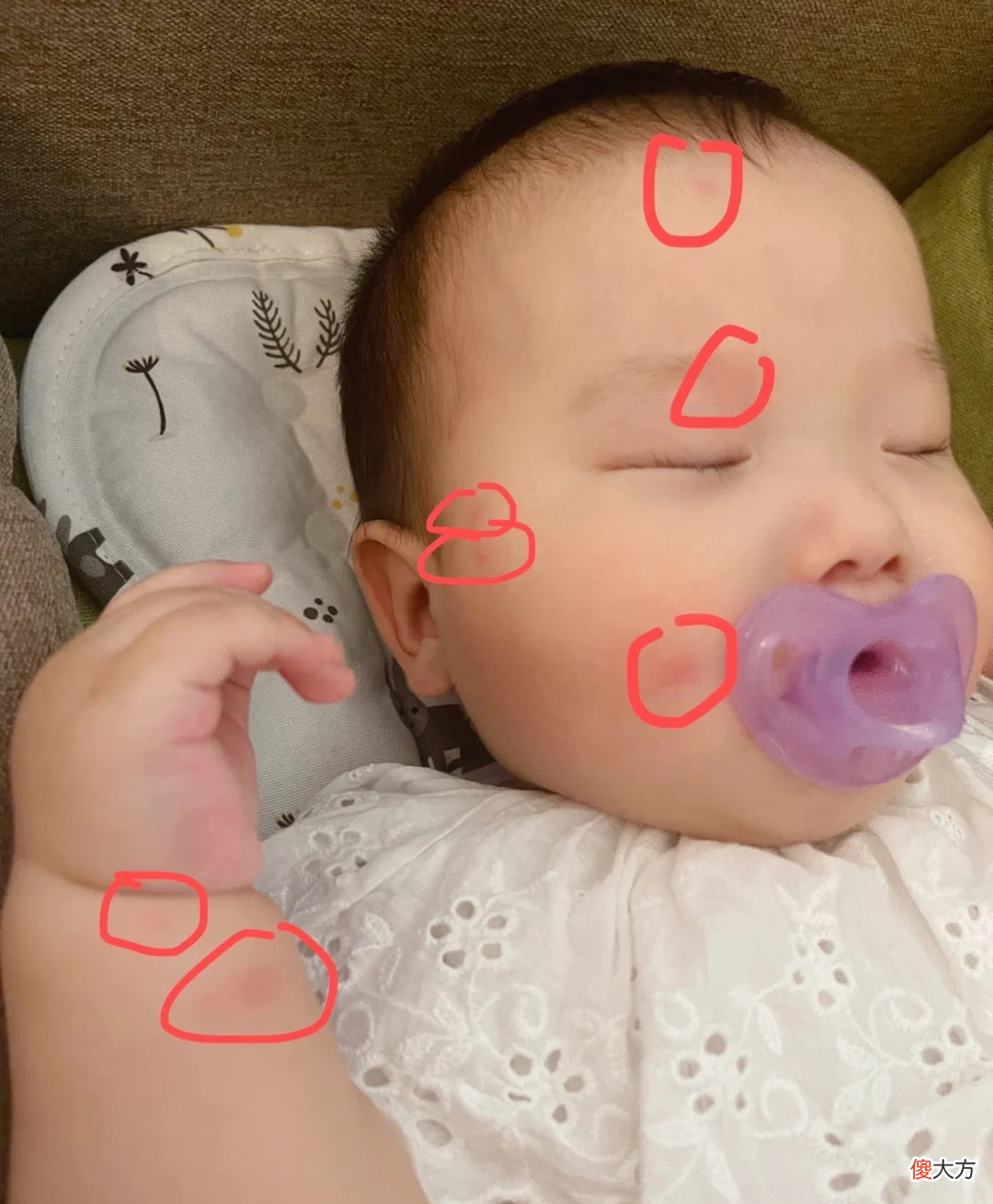 蚊子专咬O型血的宝宝?夏季防蚊正当时,不妨试试这3大妙招