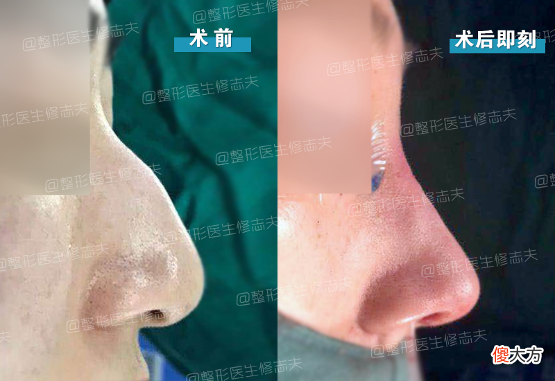 【就爱时尚】鼻子做成这样,你可会喜欢?
