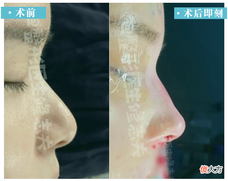 【就爱时尚】鼻子做成这样,你可会喜欢?