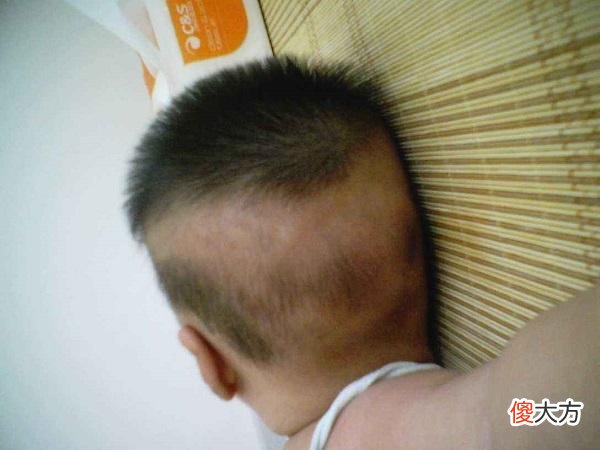 儿童出汗多，要分清生理、病理性，“内热重”的5个特征也别忽视