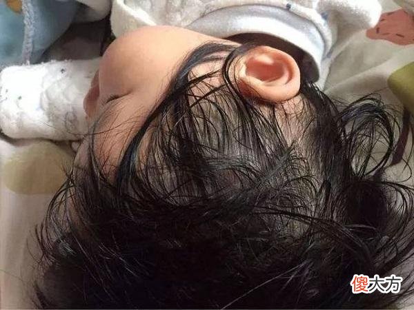 儿童出汗多，要分清生理、病理性，“内热重”的5个特征也别忽视