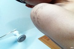 胎记由来引网友热议：不知道怎么来的，或许能知道上辈子是咋没的