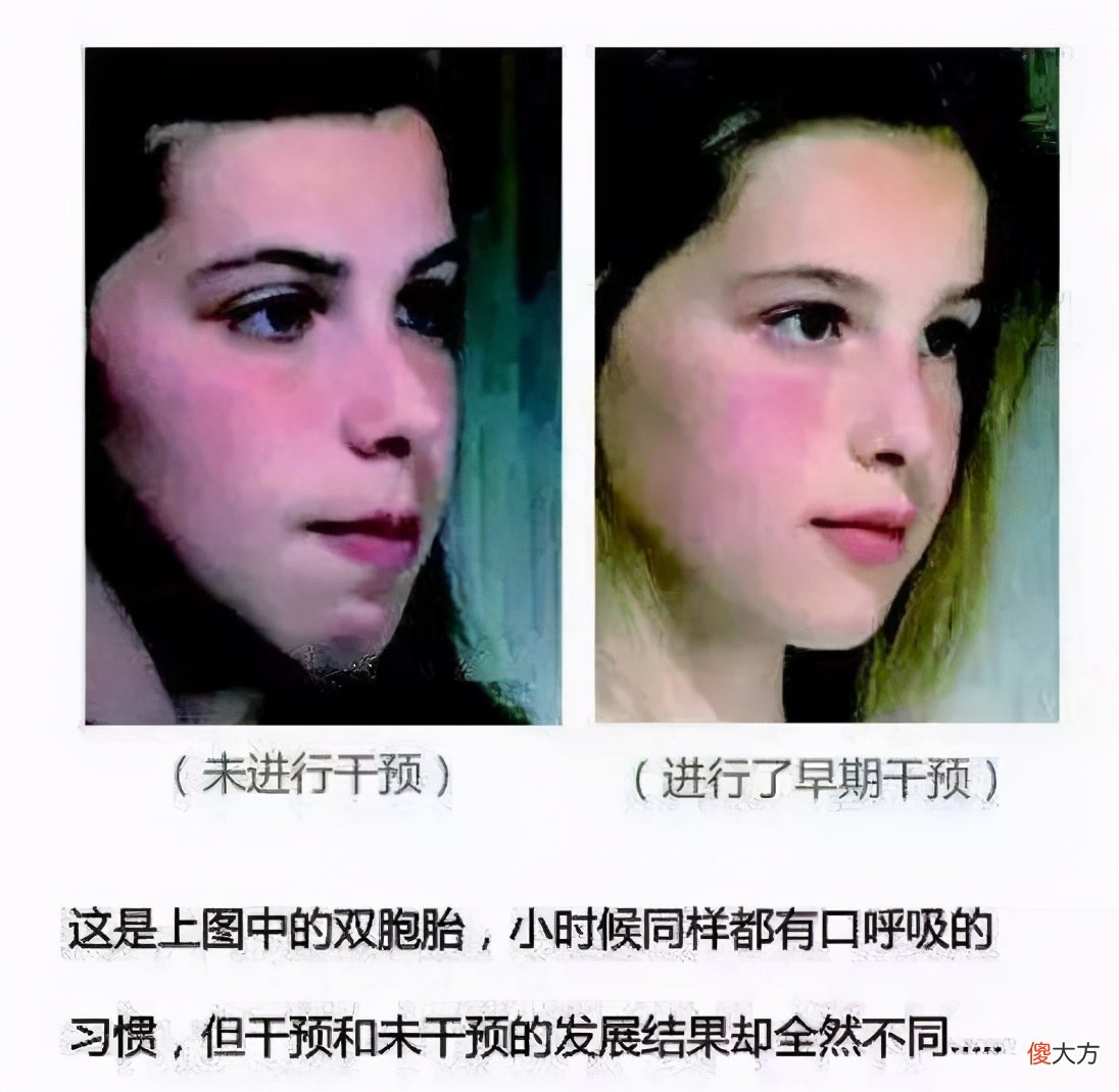 孩子出生时,这3个地方越丑,长大颜值会越高,占一条就偷着笑吧