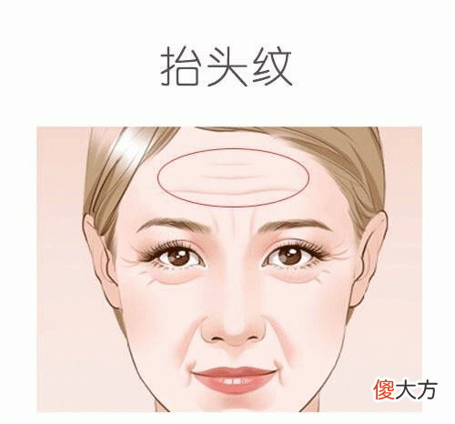 相面抬头纹，抬头纹算命图解