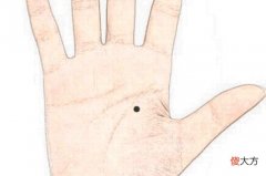 手心有痦子是什么意思？