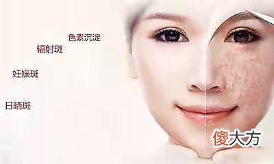 【就爱时尚】“抗衰”的正确方法，“冻龄”还不简单？