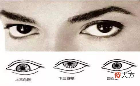 什么是三白眼，三白眼预示着什么