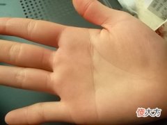 断掌纹到底意味着什么