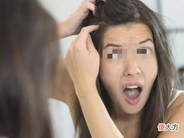 为什么越来越多孩子“少白头”？和这3个因素有关，家长别忽视了