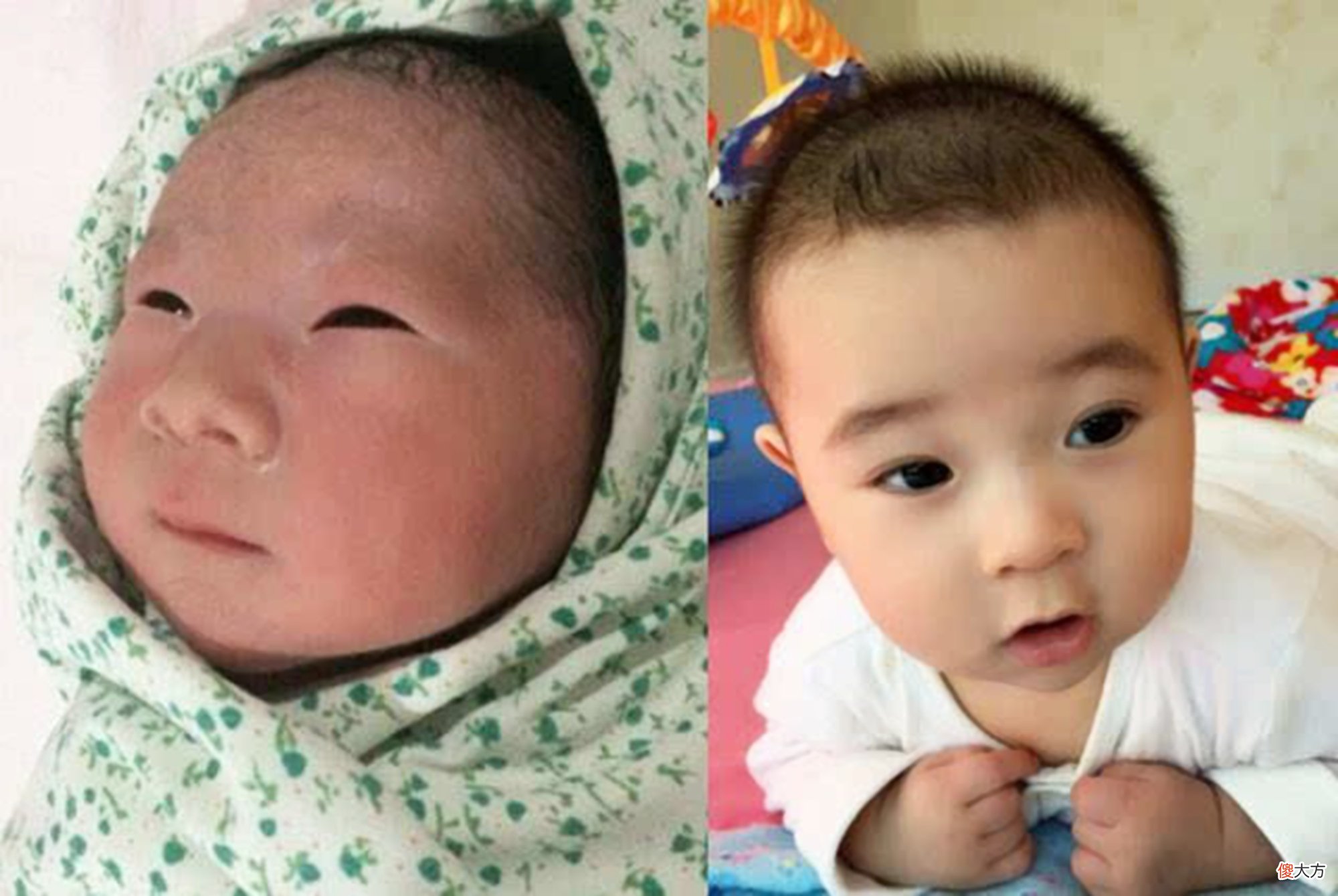 囟门是孩子的“天气预报”?若有这些表现,说明孩子很健康