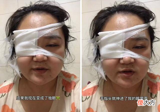 我为你剖腹7层，你却让我变“独眼”，宝宝的“杀伤期”别大意