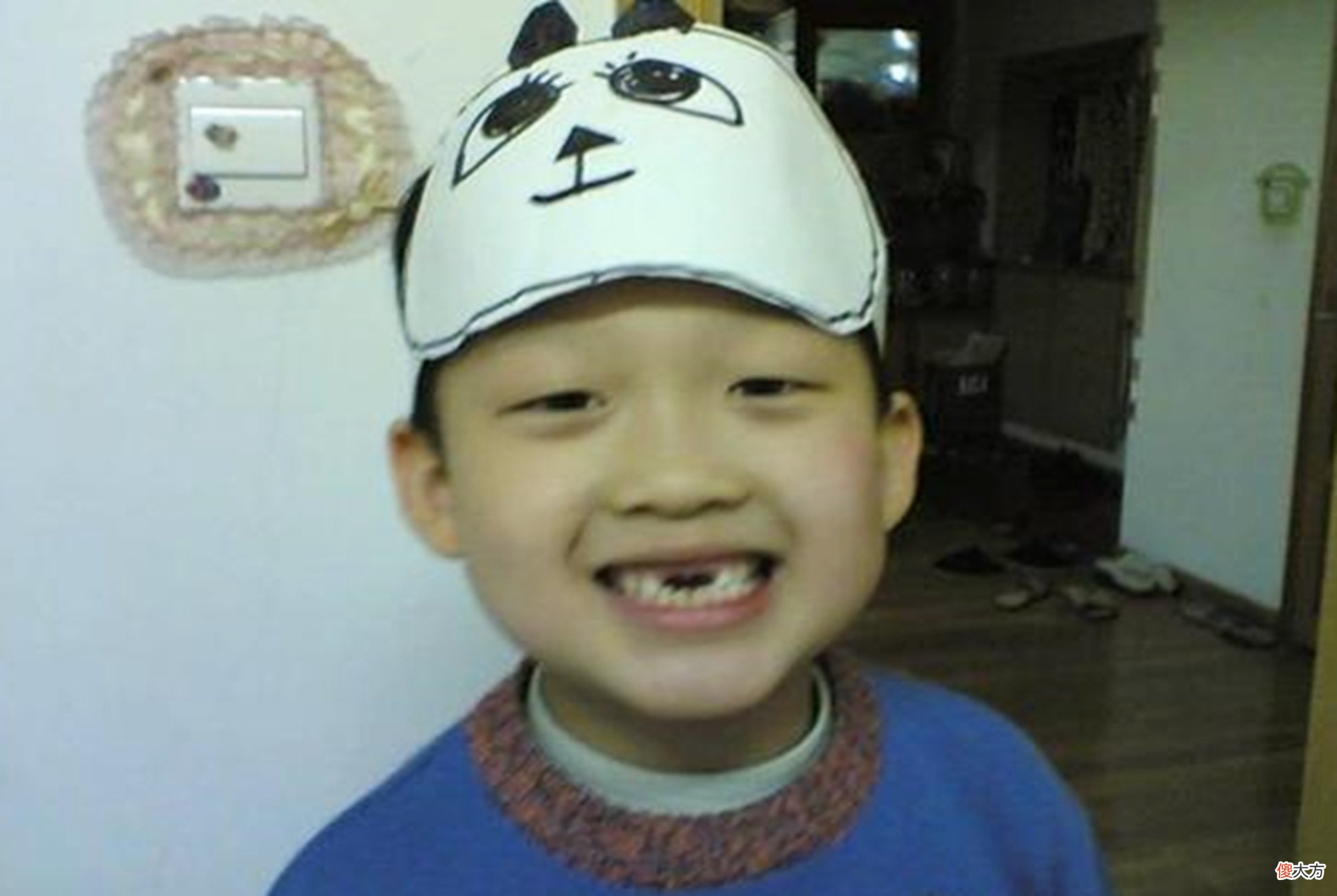 有种丑叫“乳牙坏掉”,地包天、双排牙皆因于此,父母却毫不在意