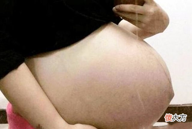 “尖是男孩,圆是女孩?”别乱猜了,孕期这些反应和胎儿性别无关