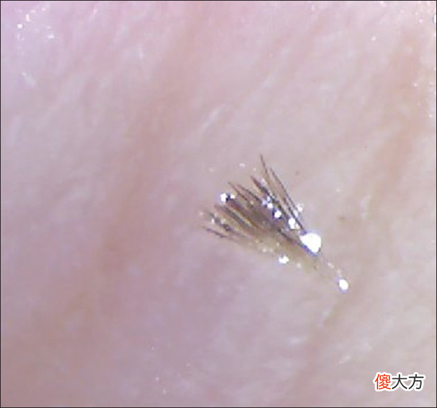 【就爱时尚】黑头、毛孔粗大、鼻翼泛红……鼻子4种皮肤问题这样应对！
