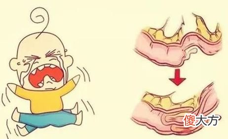 宝宝不明原因便血？别傻傻以为是食物过敏了！小心是“它”在作祟！