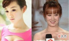 【就爱时尚】陈浩民微整形，看到照片后，网友：看了想笑