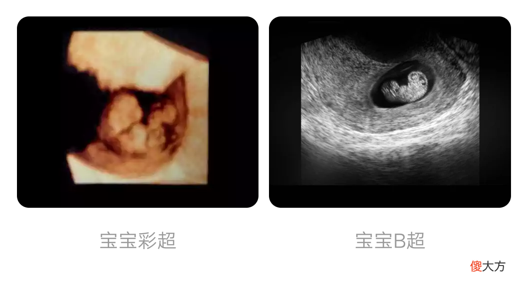 怀孕5-6周，胎儿是什么样子？胎宝宝的模样妈妈们一定想不到