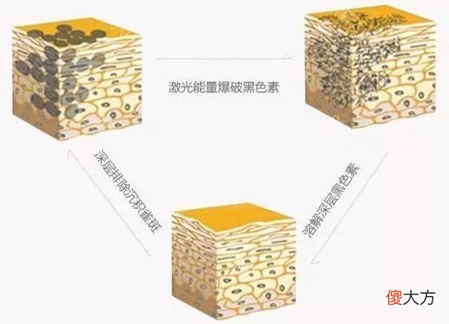 【就爱时尚】不动刀、不注射 这些明星都在做的轻医美项目效果真的那么神吗?