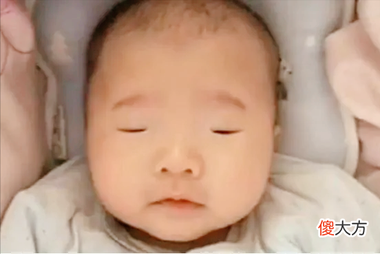 新生宝宝身上现“异样”，吓坏新手爸妈，你知道婴儿青斑怎么来吗