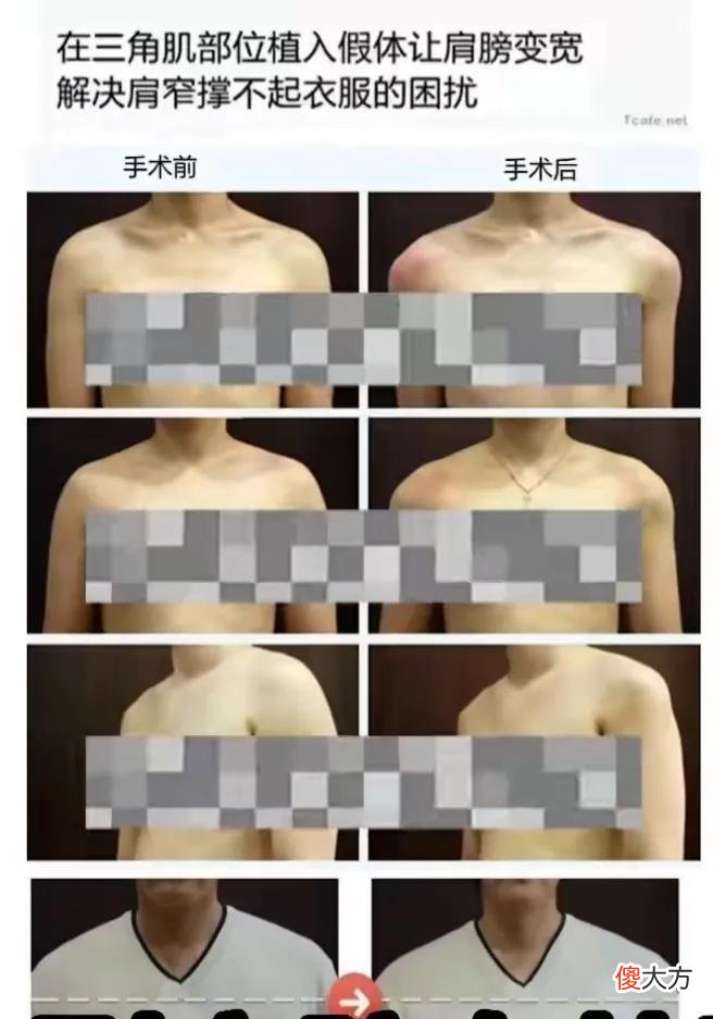 【就爱时尚】润唇膏抹脸，倒三角宽肩，韩国这个潮流真让人看不懂