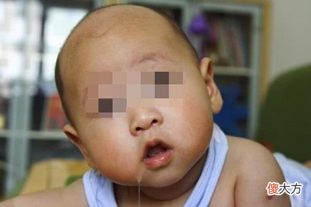 宝宝老爱流口水，戴围兜都不管用？这些常见的原因，宝妈对照一下