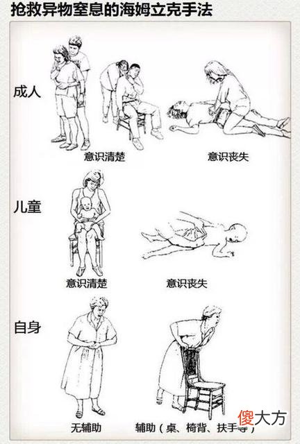 如果没有这个老师，孩子可能就死了，由此可见急救常识的重要性