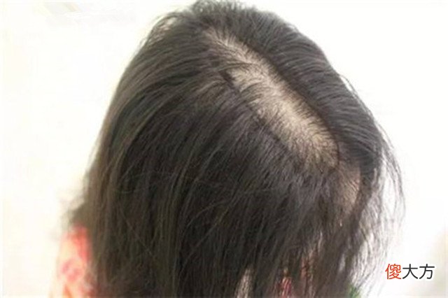 孕妈担心头发和胎宝争营养，一改“黑长直”形象，剪成假小子发型