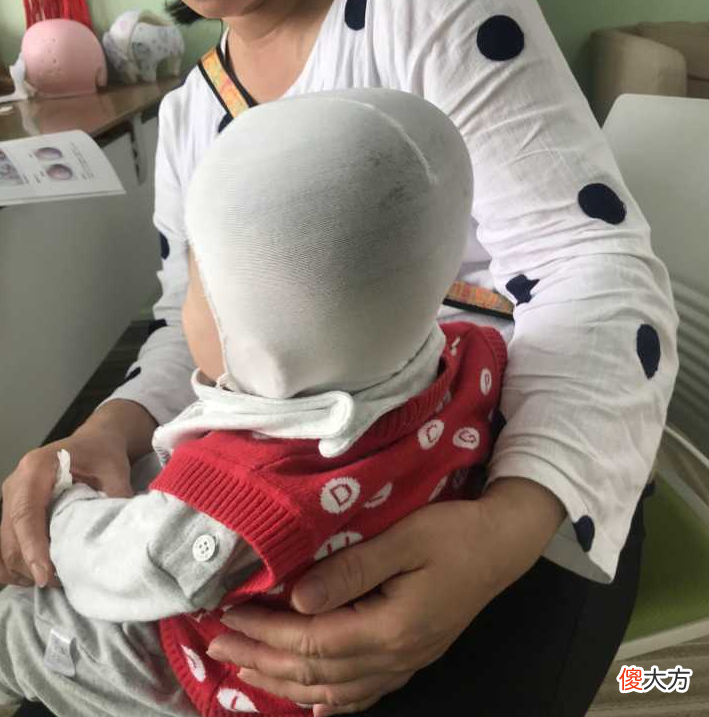 外貌焦虑波及宝宝，给婴儿带“头型矫正器”矫正头型，咋想的啊