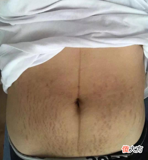 “仙女”到“大妈”只有一个娃的距离，变油腻的特征，你占了几个