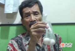 能下蛋的男人:印尼一男子竟每三月产蛋一次