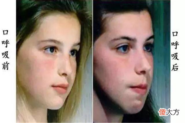 曾惊艳了岁月的童星，长大后颜值落差太大，网友：这是个看脸的时代