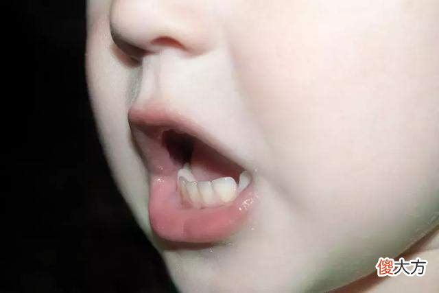 孩子长时间用嘴呼吸，长相会变丑吗？看看研究调查结果显示